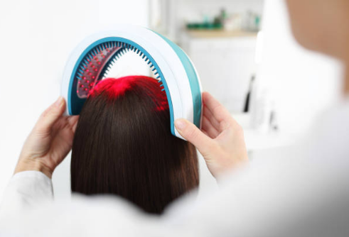 Low Level Light Therapy for Hair Loss (LLLT)
